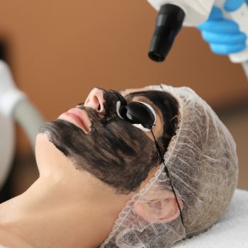 1705578469_Carbon LASER Peel.jpg